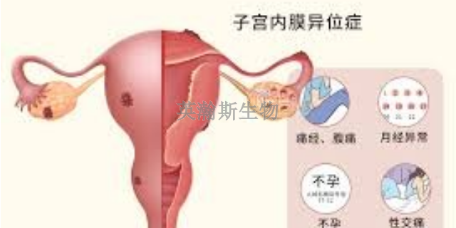 海南子宮內(nèi)膜異位癥模型造模方法,子宮內(nèi)膜異位癥模型