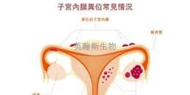 重庆专业的子宫内膜异位症模型,子宫内膜异位症模型