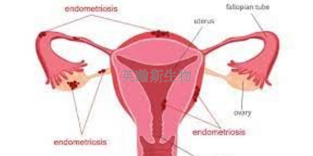 青海小鼠子宫内膜异位症模型