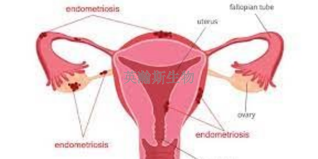 甘肅靠譜的子宮內膜異位癥模型哪家口碑好