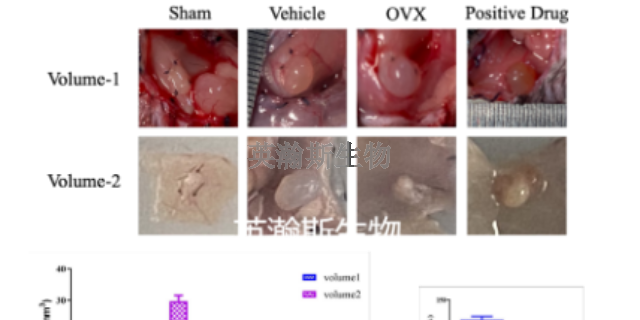 山东专门做子宫内膜异位症模型是哪家