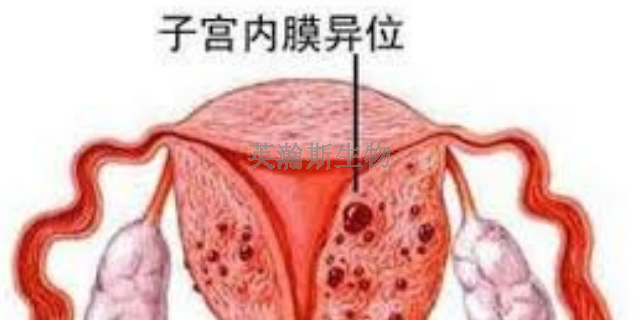 河北大鼠子宫内膜异位症模型动物实验外包