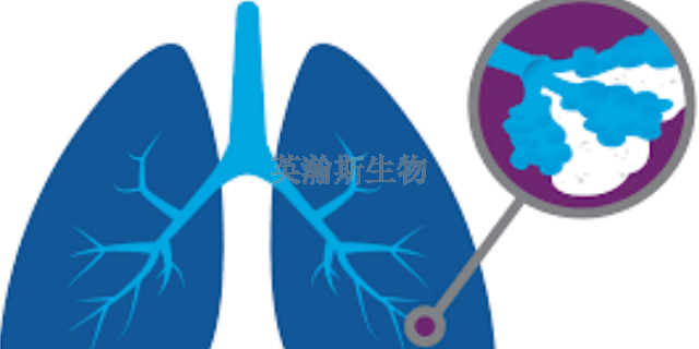 贵州大鼠肺纤维化模型有哪家,肺纤维化模型