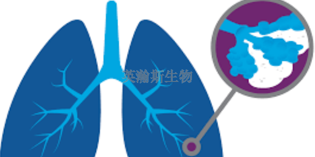 宁夏真实的肺纤维化模型动物实验外包