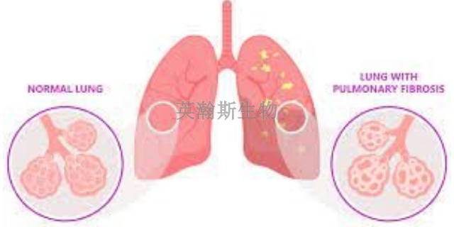 西藏比較好的肺纖維化模型造模方法,肺纖維化模型