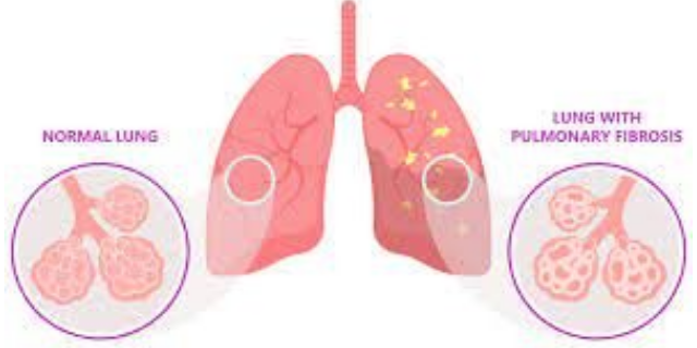 江蘇推薦的肺纖維化模型如何構(gòu)建 來電咨詢 南京英瀚斯生物科技供應(yīng)