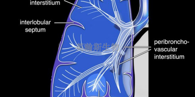 内蒙古肺纤维化模型有哪家,肺纤维化模型