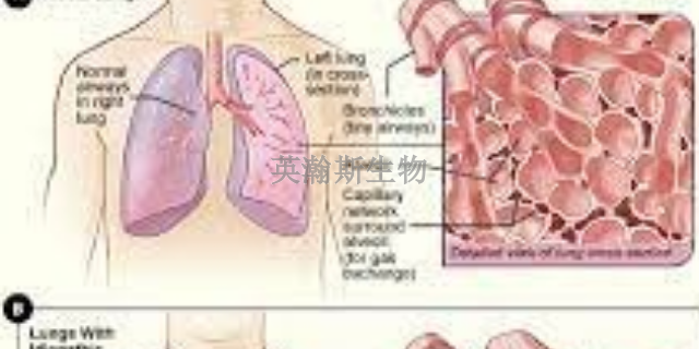 江苏推荐的肺纤维化模型
