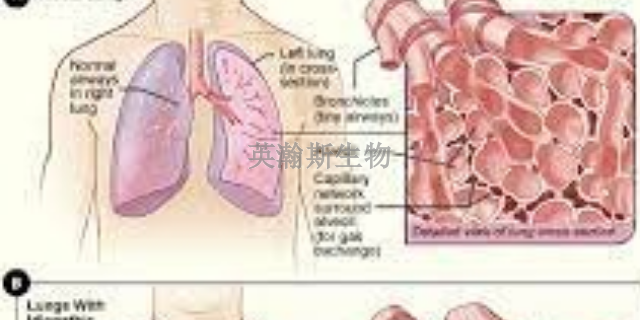 甘肅小鼠肺纖維化模型哪家口碑好,肺纖維化模型