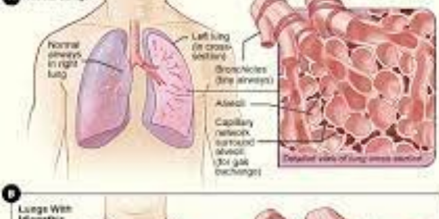 海南靠譜的肺纖維化模型 歡迎來(lái)電 南京英瀚斯生物科技供應(yīng)