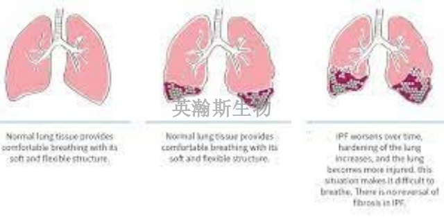 海南肺纤维化模型是哪家