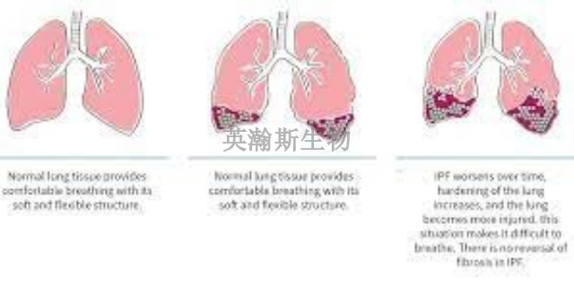 海南肺纖維化模型是哪家