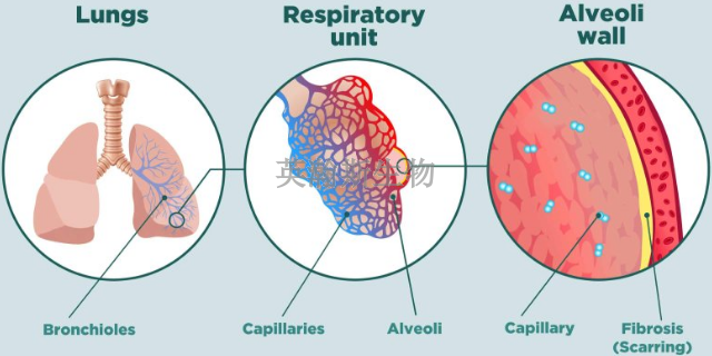 河南推薦的肺纖維化模型動物實驗外包,肺纖維化模型