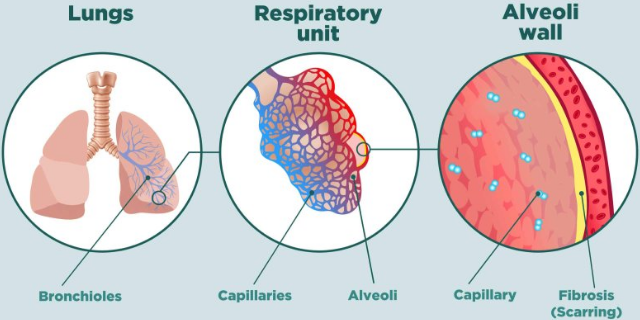 江蘇專(zhuān)業(yè)的肺纖維化模型是哪家 歡迎咨詢 南京英瀚斯生物科技供應(yīng)