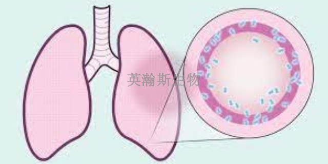 吉林專門做肺纖維化模型動物實驗外包,肺纖維化模型