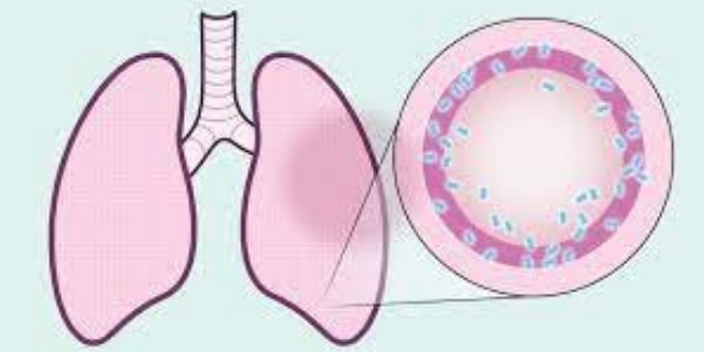 河北真實的肺纖維化模型如何構(gòu)建 值得信賴 南京英瀚斯生物科技供應(yīng)