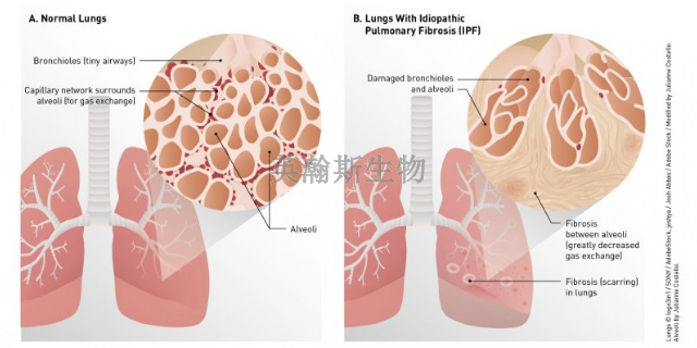 内蒙古肺纤维化模型有哪家,肺纤维化模型
