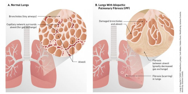 吉林小鼠肺纖維化模型造模方法 歡迎咨詢 南京英瀚斯生物科技供應(yīng)