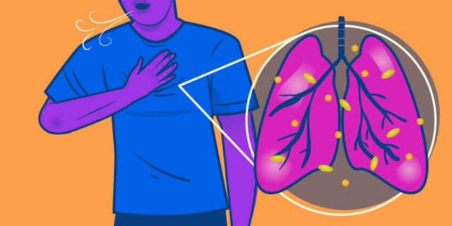 浙江比較好的肺纖維化模型有哪家 值得信賴 南京英瀚斯生物科技供應(yīng)