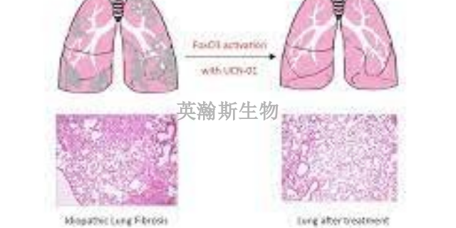 浙江比较好的肺纤维化模型有哪些