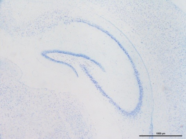 南京阿里辛藍(lán)-過(guò)碘酸雪夫染色價(jià)格 值得信賴 南京英瀚斯生物科技供應(yīng)