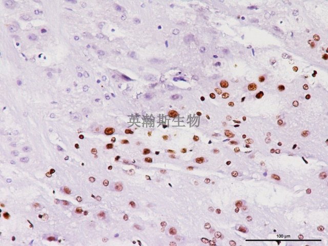 南京阿里辛蓝-过碘酸雪夫染色公司哪家好 来电咨询 南京英瀚斯生物科技供应