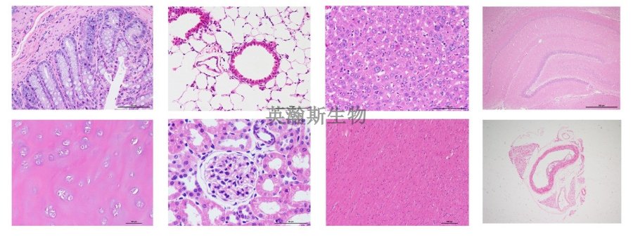 南京Masson染色外包 欢迎咨询 南京英瀚斯生物科技供应