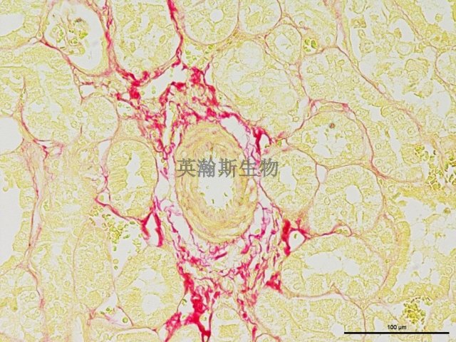 南京Van Gieson染色结果分析 欢迎咨询 南京英瀚斯生物科技供应