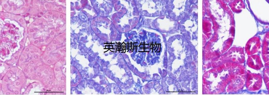 南京免疫组化染色公司哪家好 欢迎来电 南京英瀚斯生物科技供应