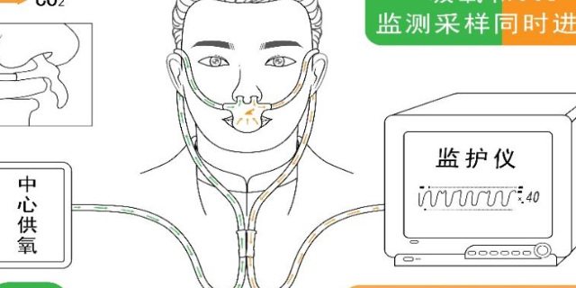 北京一次性使用呼吸回路厂家,呼吸回路