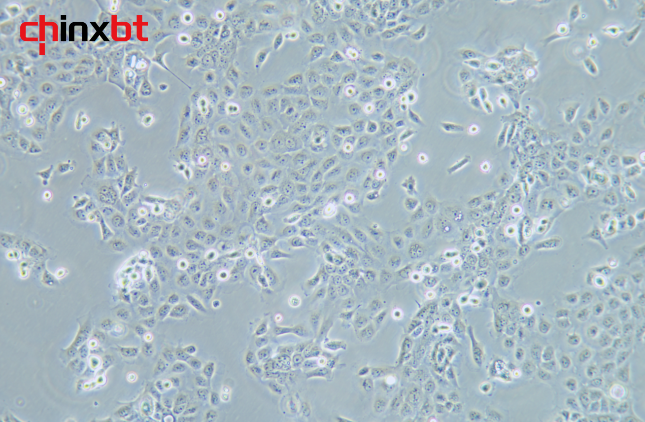 CASKI 人宫颈癌细胞_南京中欣博泰生物技术有限公司