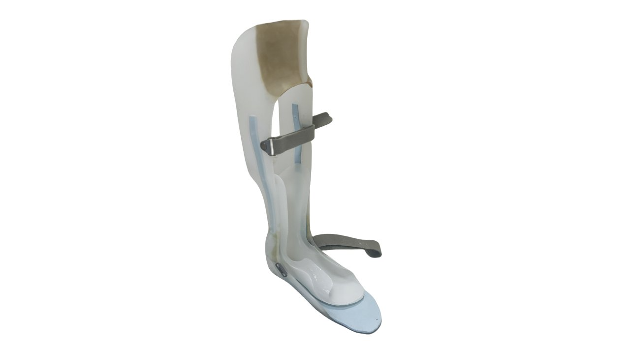 中山矫形器多少钱 服务为先 佛山市永坚假肢矫形器供应